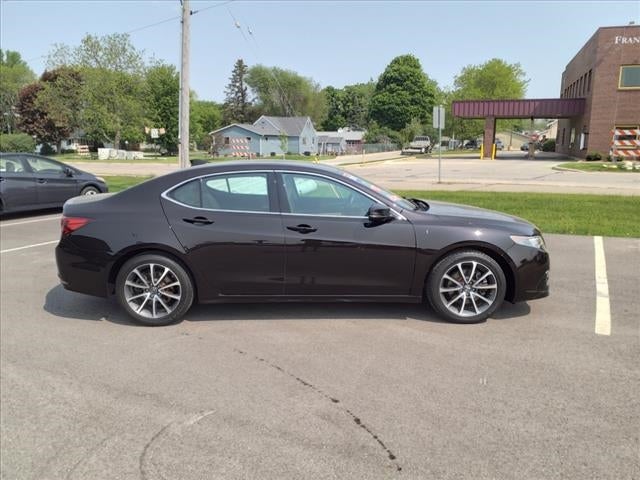 Used 2015 Acura TLX Technology Package with VIN 19UUB2F50FA000451 for sale in Zumbrota, Minnesota
